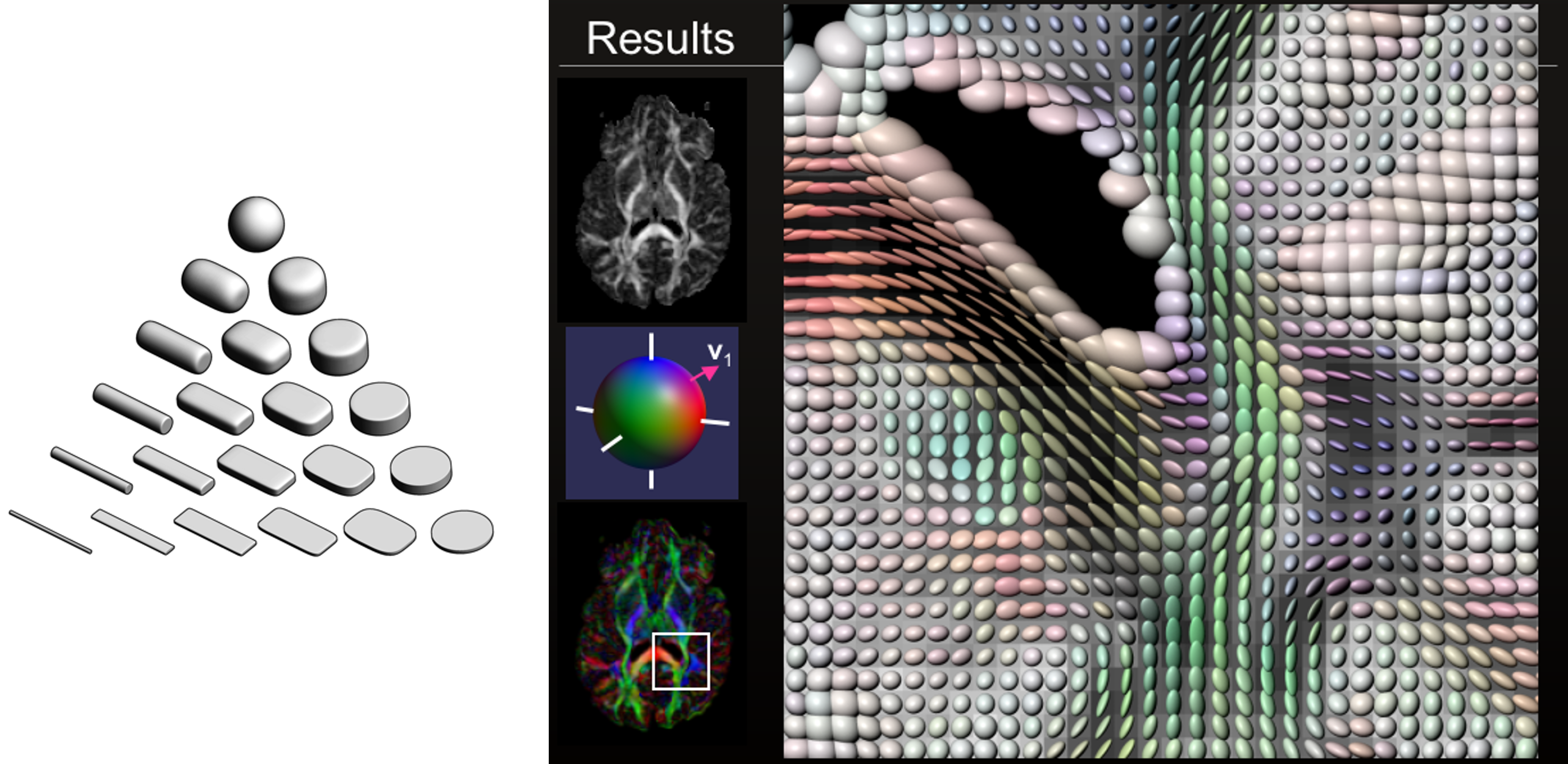 ../../_images/visualization-scientific-mri.png